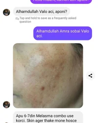 melasma-repair-combo-review-4.webp